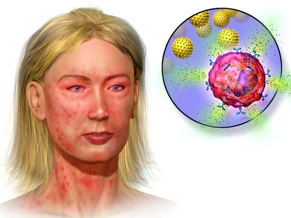 Échinocoques et symptômes de leur présence dans le corps