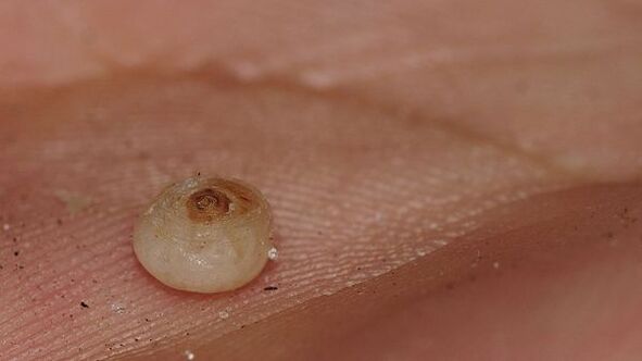 Sarcopsillose à parasites sous-cutanés