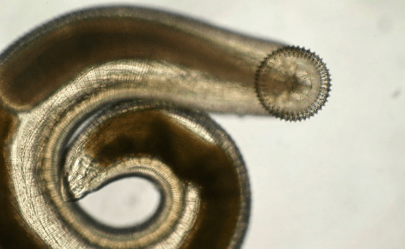gnathostome parasitaire sous-cutané
