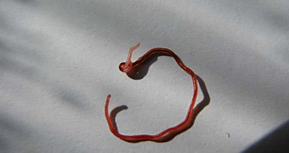 ver parasite sous-cutané de l'homme