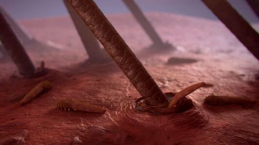 parasites sous-cutanés humains au microscope